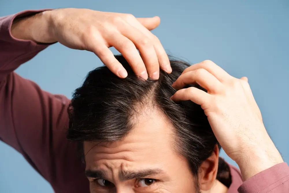 Finasteride / Biotin / Minoxidil