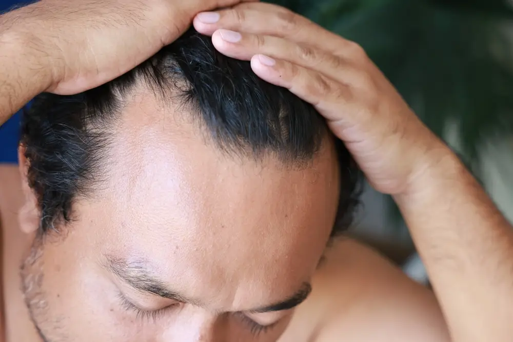 Man examining his receding hairline